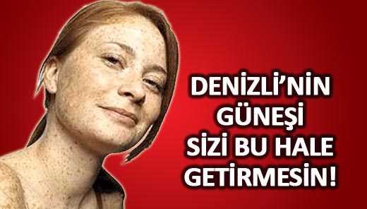 Denizlinin Güneşi Sizi Yaşlandırmasın Denizli Haber Denizlinin En çok 